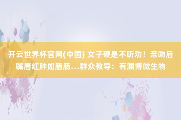 开云世界杯官网(中国) 女子硬是不听劝！亲吻后嘴唇红肿如腊肠…群众教导：有渊博微生物